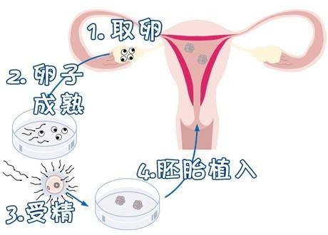林主任